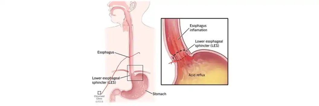 Esophagus