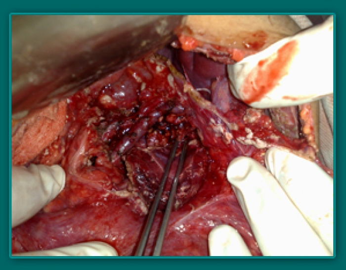 1733835374_8b725d2fc1873a2b7927