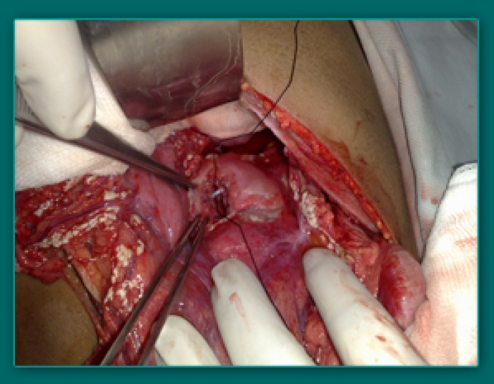 1733835479_c859ffc065dcfe7553d9