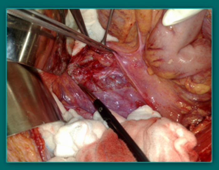 1733835509_2895553a56f5da18e251