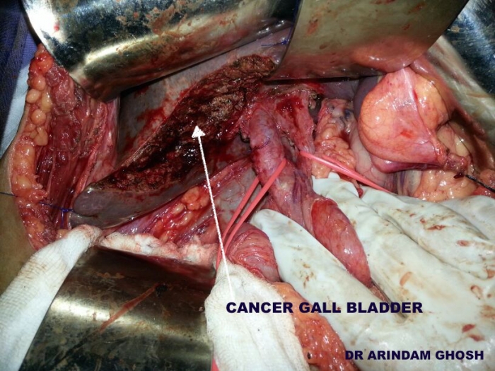 1733835781_9589eedb0ca1eda00738