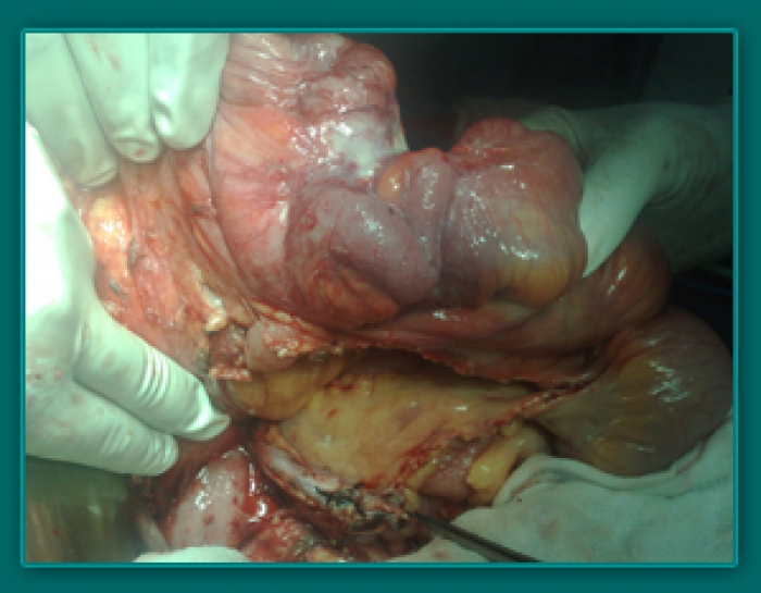 1733835825_65cc0acfcbd7ffe87a24