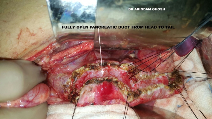 1733835857_5b5fdfa41014016eceb8