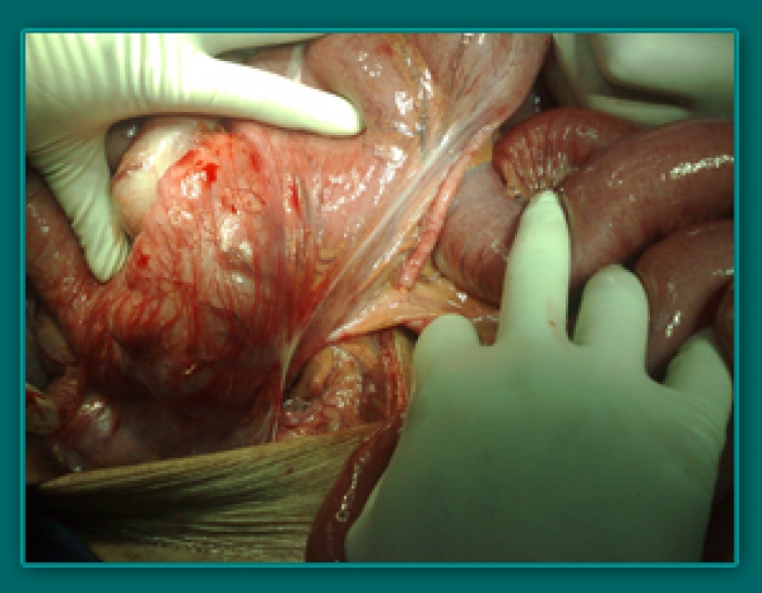 1733835878_03e1772c012b72fe8a38