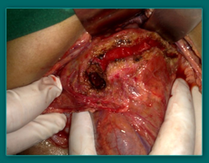 1733835948_c9398aad6293281ee8a4