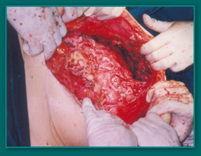 1733835971_5c2533225107b38f5e05