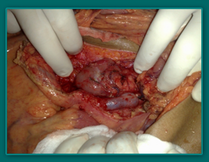 1733836050_797991a090ad2da2d32a