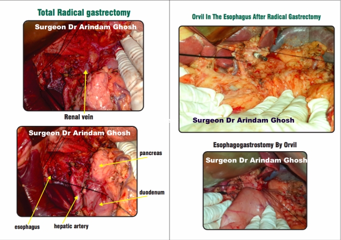 1733836309_1a5de73db25d12a5be72