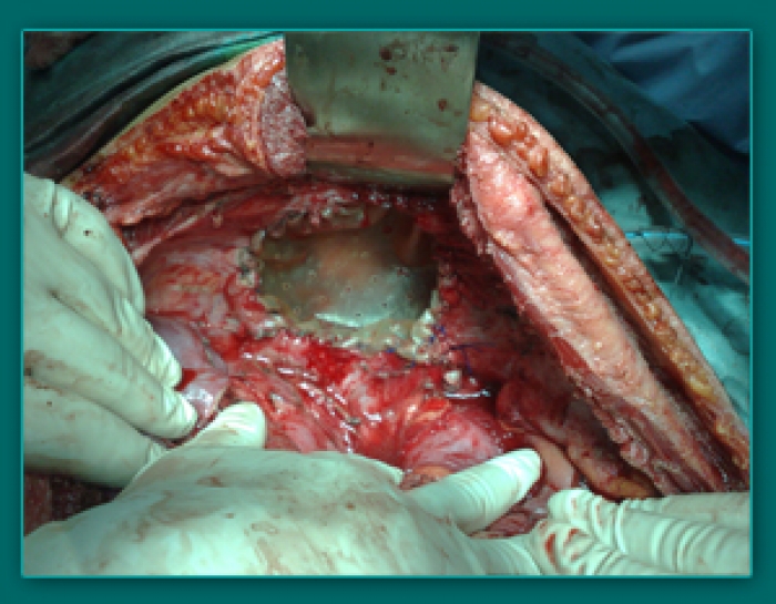 1733836521_9de71f6fa936ea806632