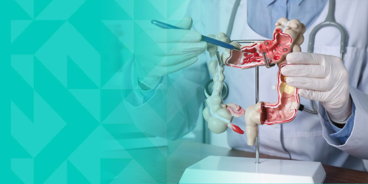 Colorectal Cancer: Early Detection and Modern Treatment Options