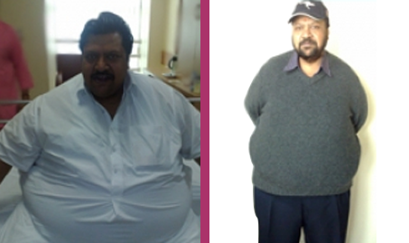 gal-1 https://drarindamghosh.com/wp-content/uploads/2026/01/gal-1.png