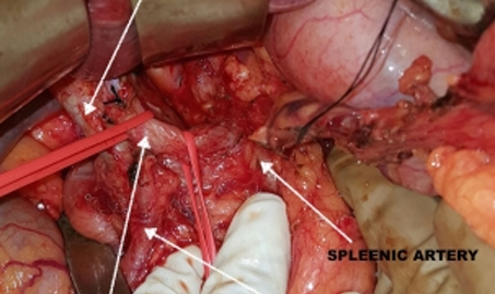 gal-2 https://drarindamghosh.com/wp-content/uploads/2026/01/gal-2.png