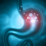 Bloating and Indigestion