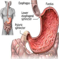 Gastric & Reflux