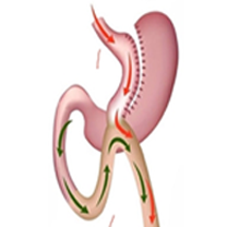 Bariatric